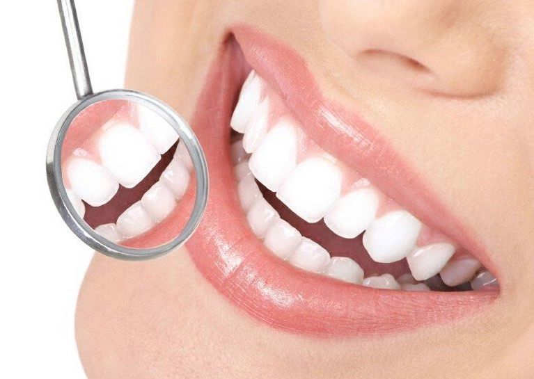 After professional teeth whitening