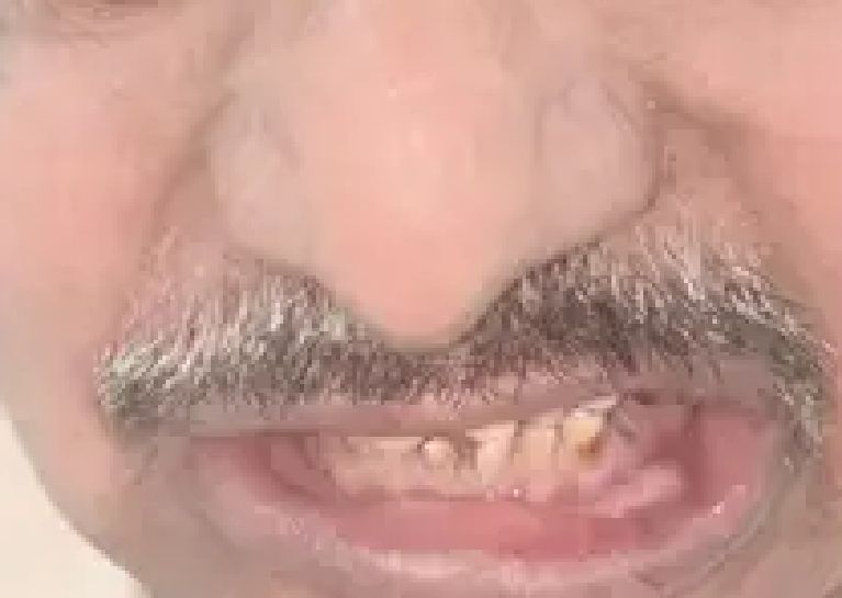 Before deep cleaning