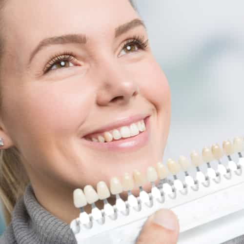 Porcelain veneer results